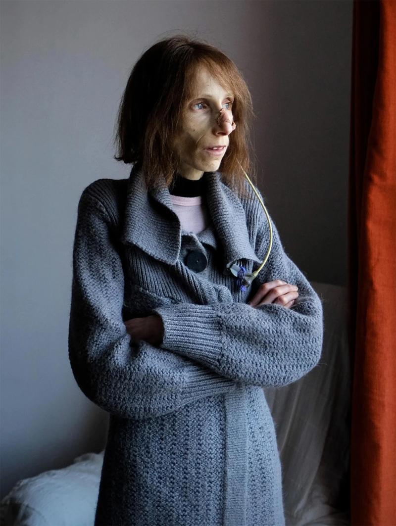 tin tuc doi song ngay 101 cuu song be trai 4 tuoi bi da chan thuong nguy kich2