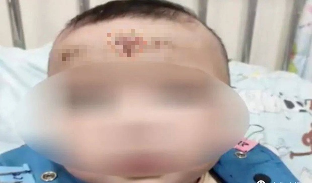 tran be gai 10 thang tuoi day man do va vet loet nguyen nhan khien ai nay giat minh tran be gai 10 thang tuoi day man do va vet loet nguyen nhan khien ai nay giat minh