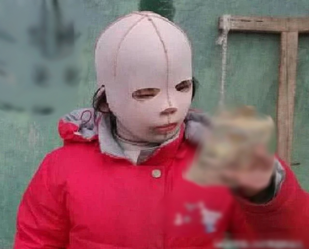 co be 10 tuoi trum mat na kin mit khi di hoc luc go ra ai nay khoc nhu mua co be 10 tuoi trum mat na kin mit khi di hoc luc go ra ai nay khoc nhu mua