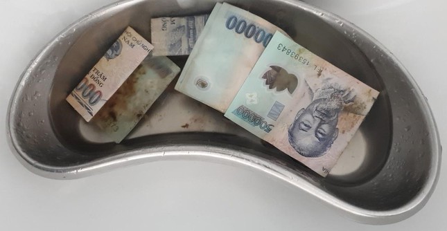 tin tuc doi song ngay 311 phau thuat gap gan 13 trieu dong trong bung nguoi phu nu tin tuc doi song ngay 311 phau thuat gap gan 13 trieu dong trong bung nguoi phu nu