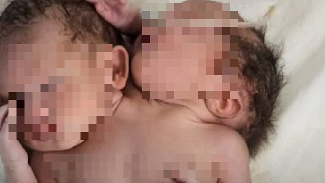 hy huu be so sinh chao doi voi 2 dau va 3 tay1 hy huu be so sinh chao doi voi 2 dau va 3 tay1