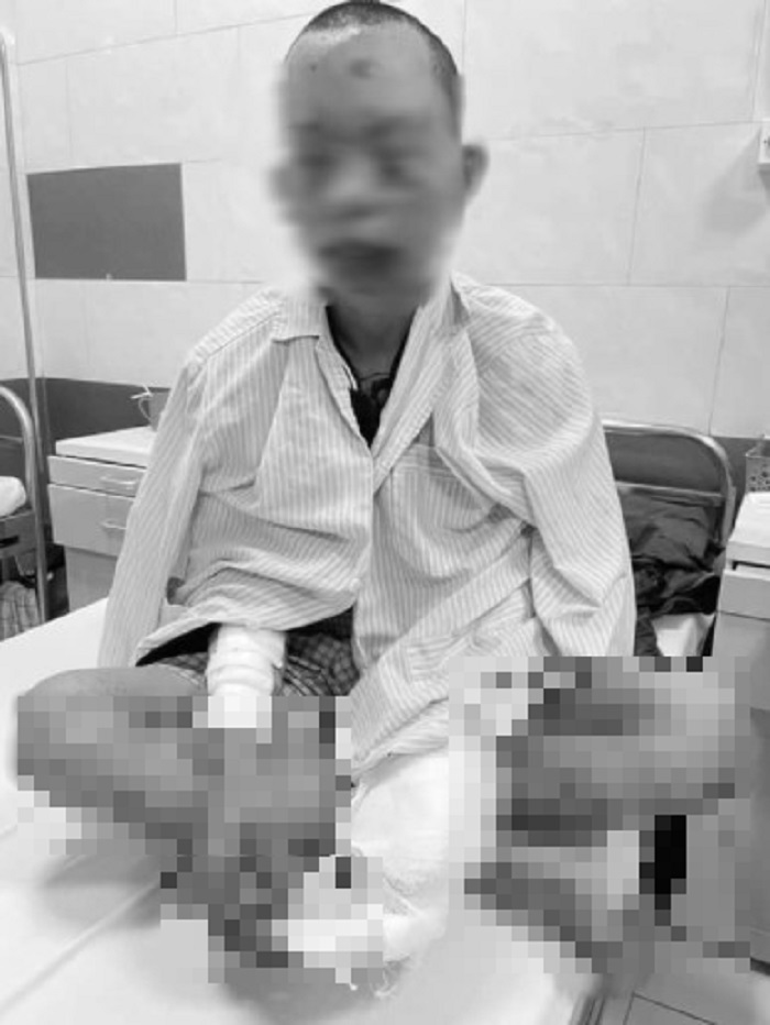 mat thi luc chay xem toan than vi su dung dien thoai khi dang sac11 mat thi luc chay xem toan than vi su dung dien thoai khi dang sac11