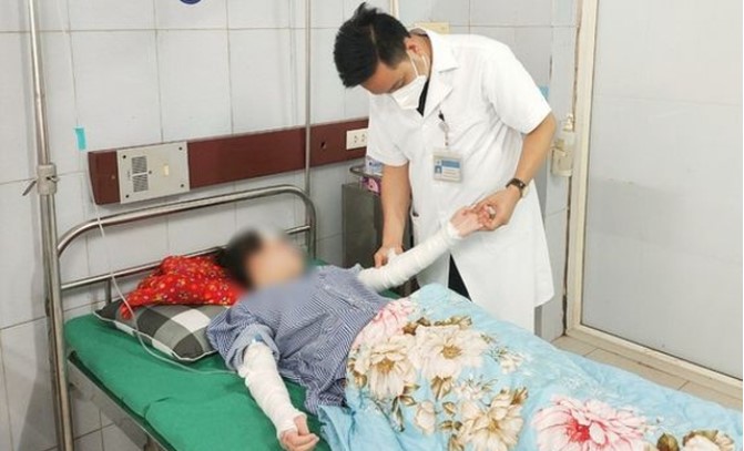 bong rat vung mat va hai canh tay vi bong bay trang tri chua khi hydro phat no bong rat vung mat va hai canh tay vi bong bay trang tri chua khi hydro phat no