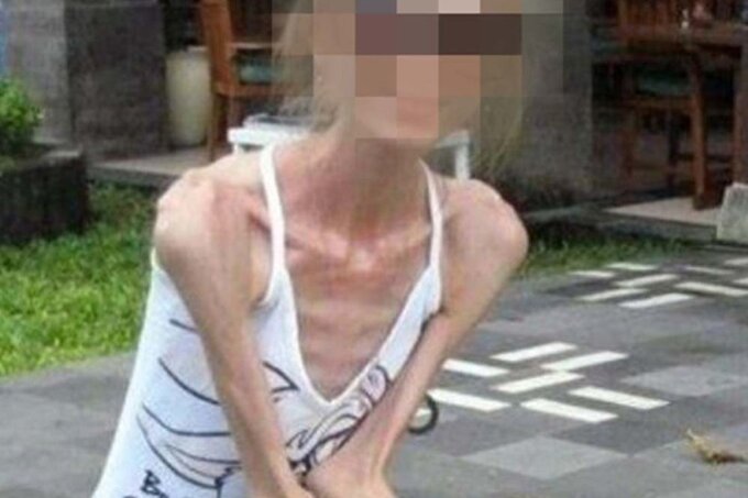 nguoi phu nu 30 tuoi chi nang 25kg ai nay giat minh khi biet nguyen nhan nguoi phu nu 30 tuoi chi nang 25kg ai nay giat minh khi biet nguyen nhan
