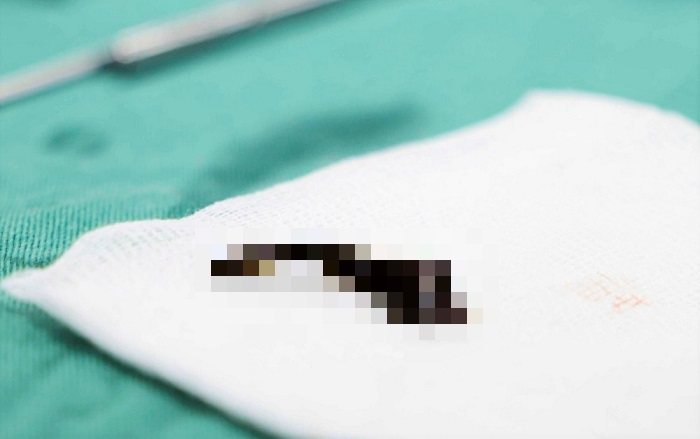 tin tuc doi song moi nhat ngay 117 chua khoi ung thu vu nho phat hien som1 tin tuc doi song moi nhat ngay 117 chua khoi ung thu vu nho phat hien som1