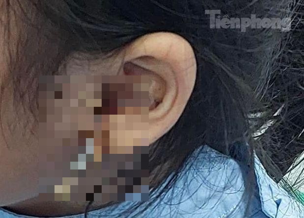 tin tuc doi song moi nhat ngay 137 cu ba di lai duoc nho ky thuat bom xi mang sinh hoc3 tin tuc doi song moi nhat ngay 137 cu ba di lai duoc nho ky thuat bom xi mang sinh hoc3