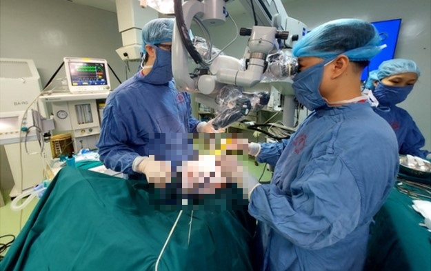 bat ngo bi meo mieng liet nua nguoi sau khi di lam dong ve bat ngo bi meo mieng liet nua nguoi sau khi di lam dong ve