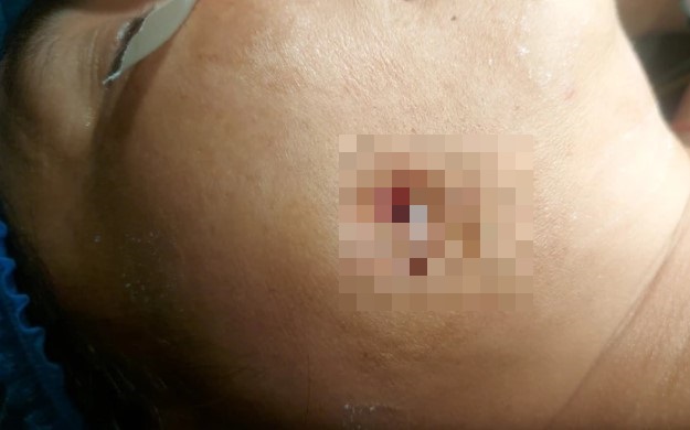 tin tuc doi song ngay 68 thung ma do bien chung rang so 48 moc lech1