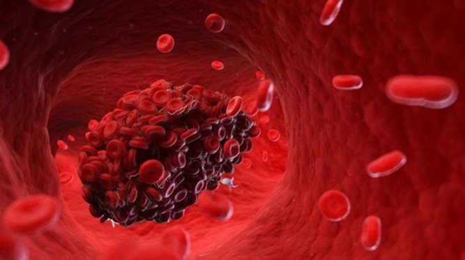 bo y te len tieng ve nguy co thieu thuoc chong dong mau trong phau thuat tim long nguc bo y te len tieng ve nguy co thieu thuoc chong dong mau trong phau thuat tim long nguc