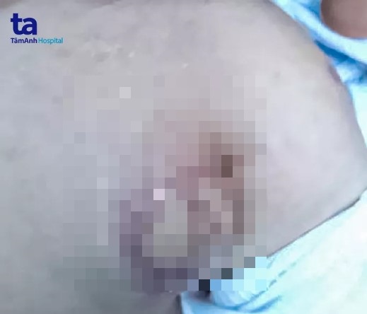 tin tuc doi song ngay 129 1 thang sut 5kg di kham phat hien khoi u o than2 tin tuc doi song ngay 129 1 thang sut 5kg di kham phat hien khoi u o than2