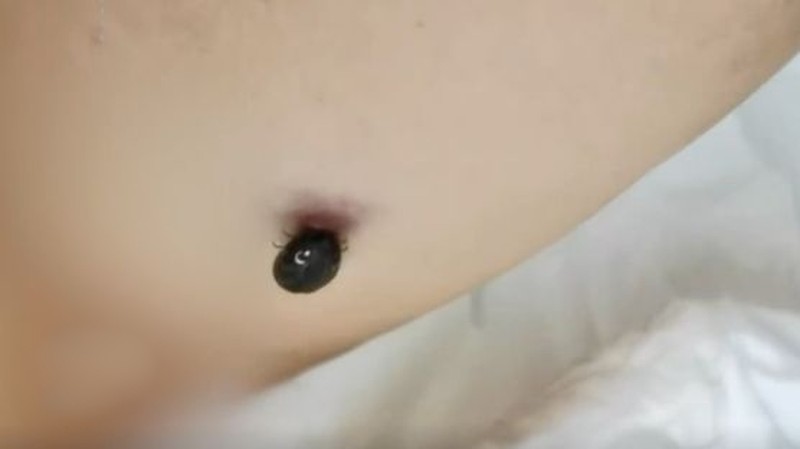 cu ong dot nhien sot cao dau dau du doi vi nguyen nhan khong ngo cu ong dot nhien sot cao dau dau du doi vi nguyen nhan khong ngo