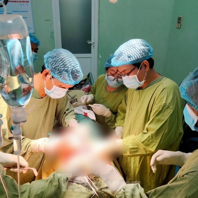 nguoi dan ong bi doan go keo dam vao nguc phai lam gay 4 xuong suon