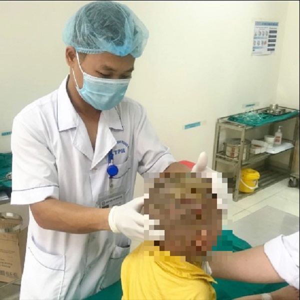 be trai 2 tuoi bi cho can ton thuong nang o vung dau mat be trai 2 tuoi bi cho can ton thuong nang o vung dau mat