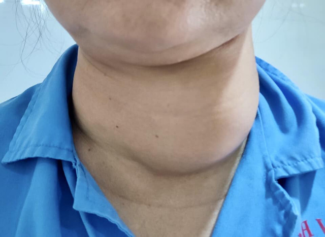 tin tuc doi song ngay 2711 nguoi dan ong bi nuoc soi doi vao nguoi gay bong 30 co the2 tin tuc doi song ngay 2711 nguoi dan ong bi nuoc soi doi vao nguoi gay bong 30 co the2