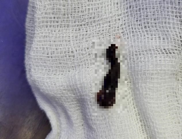 tin tuc doi song ngay 112 boc tach khoi u nang gan 1kg chen ep duong tho nguoi dan ong2 tin tuc doi song ngay 112 boc tach khoi u nang gan 1kg chen ep duong tho nguoi dan ong2