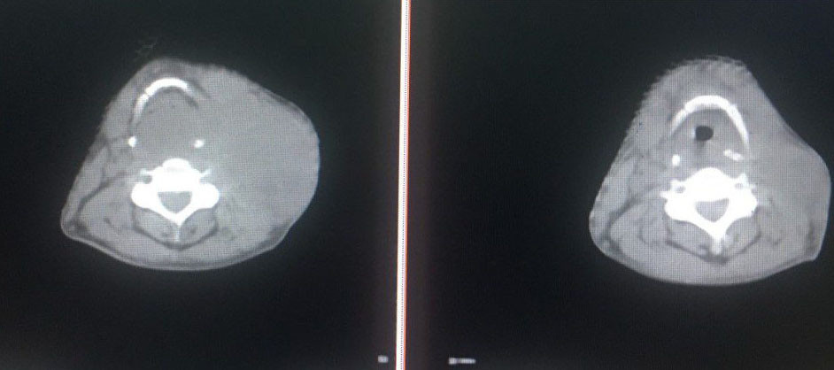 tin tuc doi song ngay 212 cuu song nam thanh nien 30 tuoi bi vo tang2 tin tuc doi song ngay 212 cuu song nam thanh nien 30 tuoi bi vo tang2