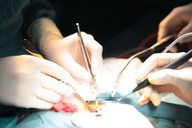 tin tuc doi song ngay 212 cuu song nam thanh nien 30 tuoi bi vo tang31 tin tuc doi song ngay 212 cuu song nam thanh nien 30 tuoi bi vo tang31