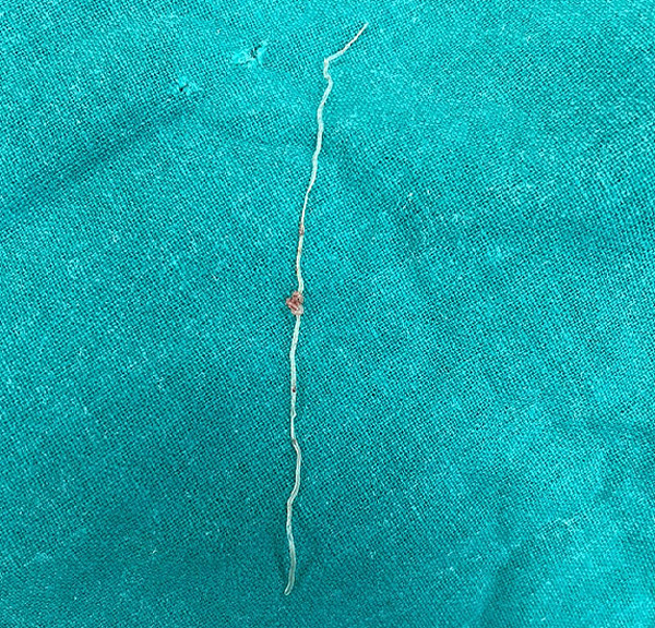 tin tuc doi song ngay 312 nguoi phu nu co giat nua mat mat ngu lien tuc suot 4 nam1 tin tuc doi song ngay 312 nguoi phu nu co giat nua mat mat ngu lien tuc suot 4 nam1