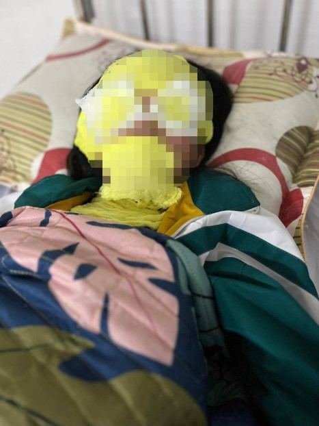 tin tuc doi song ngay 53 be gai bi bong vi bong bay bom khi hydro phat no tin tuc doi song ngay 53 be gai bi bong vi bong bay bom khi hydro phat no