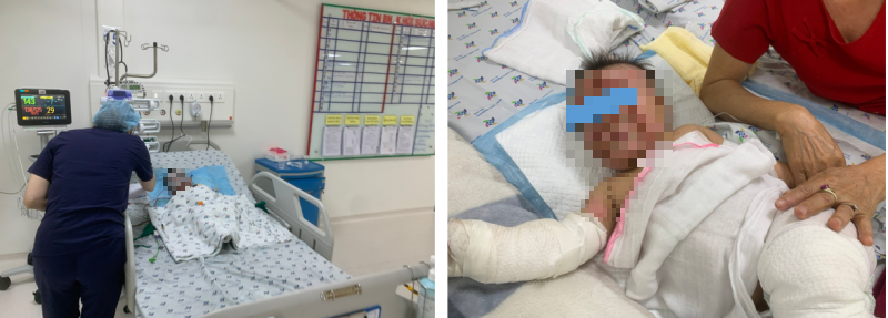 tin tuc doi song ngay 63 ba dung con nuong muc chau gai bi bong phai nhap vien1 tin tuc doi song ngay 63 ba dung con nuong muc chau gai bi bong phai nhap vien1