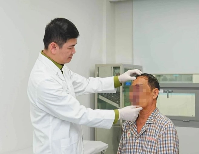 nguoi dan ong mang khoi u nhu chum nho tren mat suot 20 nam nguoi dan ong mang khoi u nhu chum nho tren mat suot 20 nam