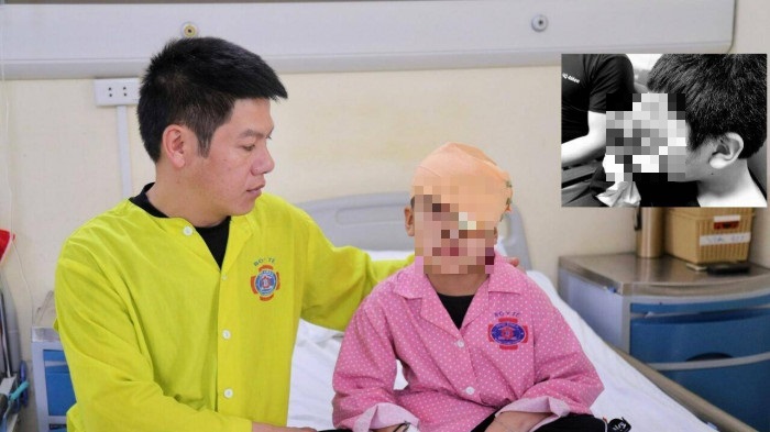 tin tuc doi song ngay 163 mac benh whitmore nguoi dan ong sot cao lien tuc 1 thang3