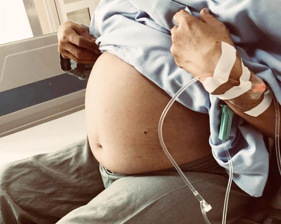 nguoi phu nu mang khoi u nang 10kg nhung tuong ngoi nhieu len can nguoi phu nu mang khoi u nang 10kg nhung tuong ngoi nhieu len can