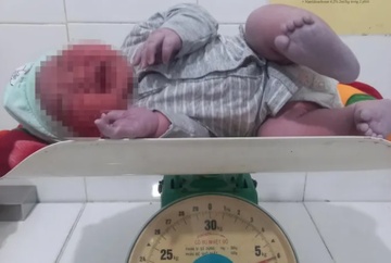 ha tinh be trai chao doi voi can nang 6kg ha tinh be trai chao doi voi can nang 6kg