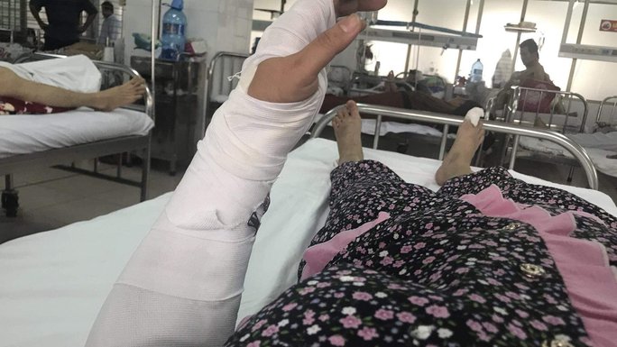 dieu tra vu chong danh vo phai nhap vien cap cuu tai da nang dieu tra vu chong danh vo phai nhap vien cap cuu tai da nang
