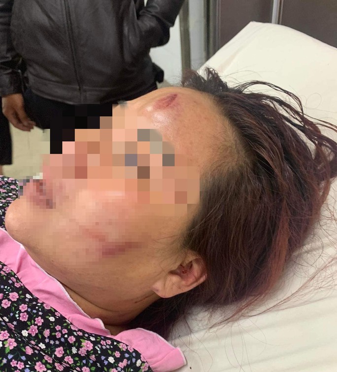 dieu tra vu chong danh vo phai nhap vien cap cuu tai da nang1 dieu tra vu chong danh vo phai nhap vien cap cuu tai da nang1