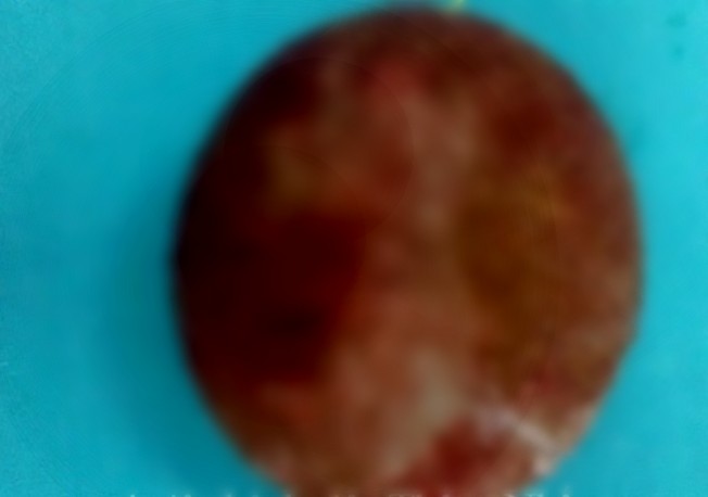 tin tuc doi song moi nhat ngay 2942023 xuong ca mac trong phe quan nguoi dan ong kho tho ho ra mau1