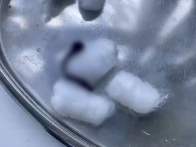 nguoi phu nu chay mau cam lien tuc trong nhieu ngay di kham phat hien thu kinh hai nguoi phu nu chay mau cam lien tuc trong nhieu ngay di kham phat hien thu kinh hai