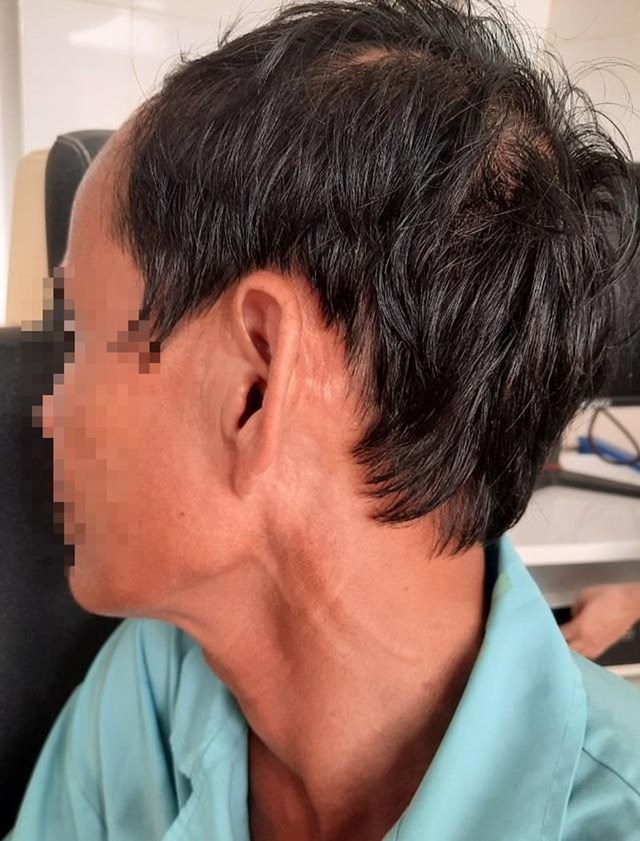 hai hung phat hien hang chuc con gioi song luc nhuc trong tai nguoi dan ong1 hai hung phat hien hang chuc con gioi song luc nhuc trong tai nguoi dan ong1