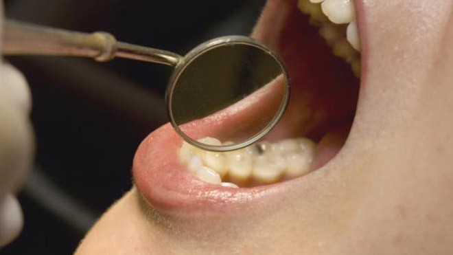 tin tuc doi song moi nhat ngay 1252023 phat hien bi ung thu sau 6 thang xuat hien khoi sui loet trong mieng tin tuc doi song moi nhat ngay 1252023 phat hien bi ung thu sau 6 thang xuat hien khoi sui loet trong mieng