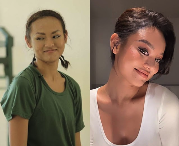 lo nhan sac khac la a hau mai ngo vuong nghi van phau thuat tham my2 lo nhan sac khac la a hau mai ngo vuong nghi van phau thuat tham my2