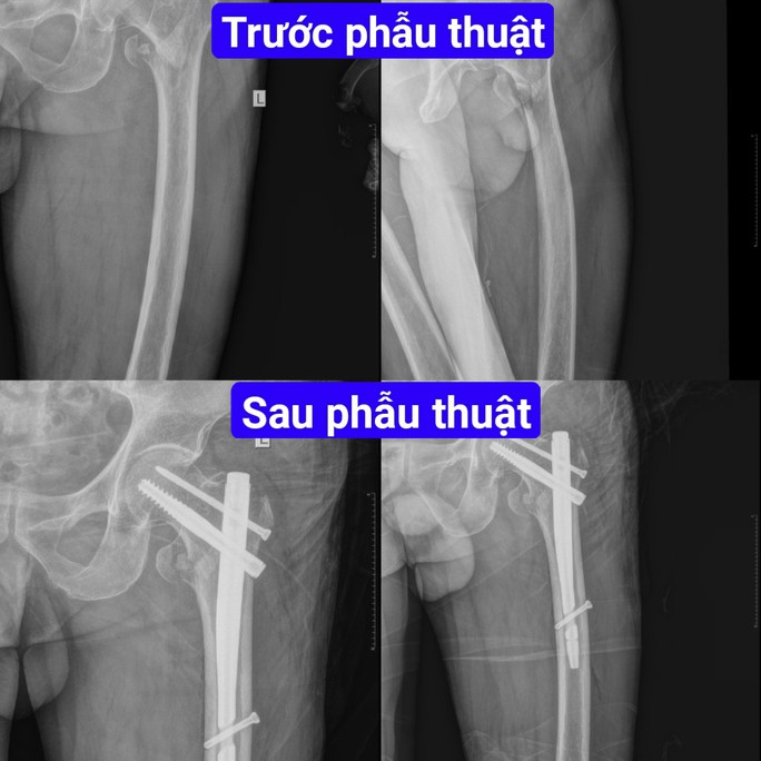 tin tuc doi song moi nhat ngay 1872023 nguoi dan ong bi kinh vo cat vao tay gay dut dong mach quay tin tuc doi song moi nhat ngay 1872023 nguoi dan ong bi kinh vo cat vao tay gay dut dong mach quay