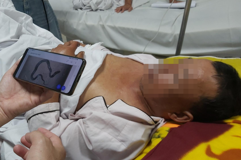 tin tuc doi song moi nhat ngay 2072023 cuu cu ba co nguy co dot tu rat cao vi bi loc tach dong mach chu1 tin tuc doi song moi nhat ngay 2072023 cuu cu ba co nguy co dot tu rat cao vi bi loc tach dong mach chu1