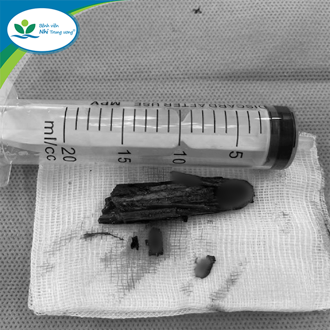 tin tuc doi song moi nhat ngay 2072023 cuu cu ba co nguy co dot tu rat cao vi bi loc tach dong mach chu2 tin tuc doi song moi nhat ngay 2072023 cuu cu ba co nguy co dot tu rat cao vi bi loc tach dong mach chu2