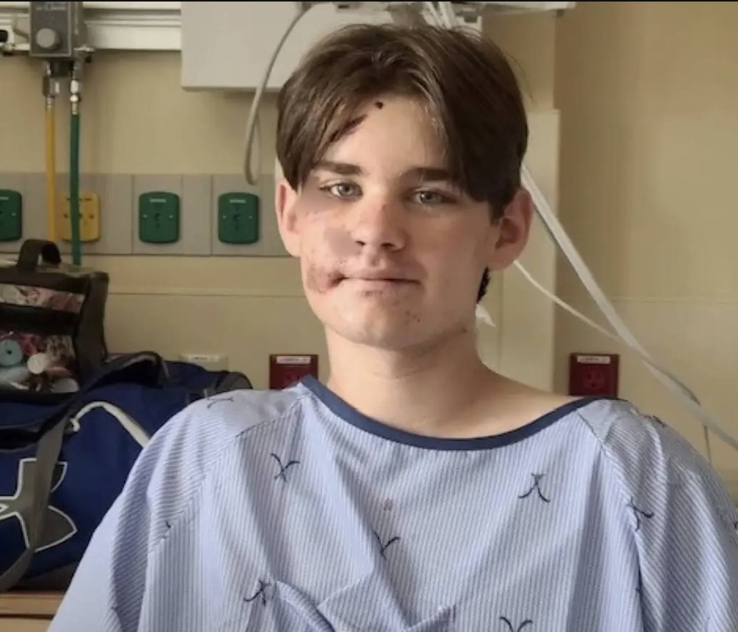 thieu nien 13 tuoi song sot ky dieu sau khi roi xuong hem nui sau gan 30m