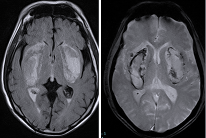 tin tuc doi song moi nhat ngay 1782023 mat thi luc nguy co song thuc vat sau khi uong con pha nuoc loc
