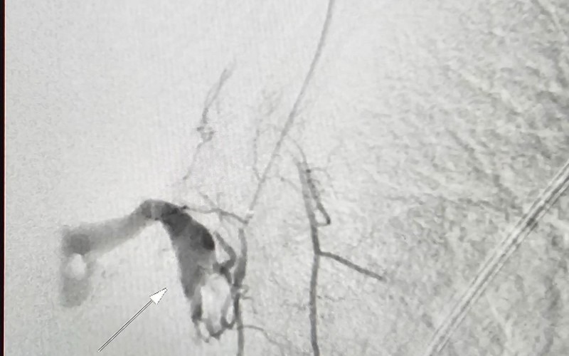 tin tuc doi song moi nhat ngay 2392023 bi ran can ngon chan nguoi phu nu co nguy co hoai tu2 tin tuc doi song moi nhat ngay 2392023 bi ran can ngon chan nguoi phu nu co nguy co hoai tu2