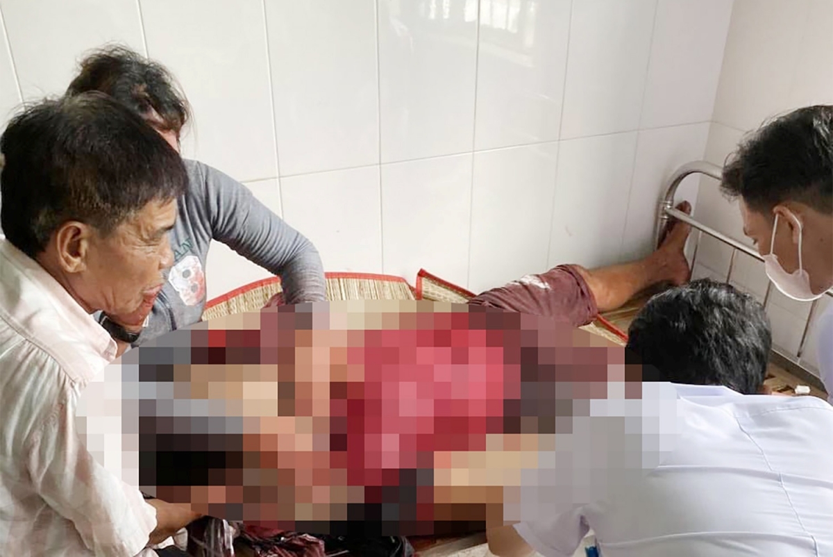ca mau dieu tra vu nguoi dan ong bi chem tu vong khi dang ngoi can cua ca mau dieu tra vu nguoi dan ong bi chem tu vong khi dang ngoi can cua