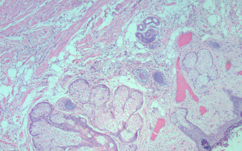 tin tuc doi song moi nhat ngay 1122023 cu ong 94 tuoi soc phan ve do bi muoi dot2