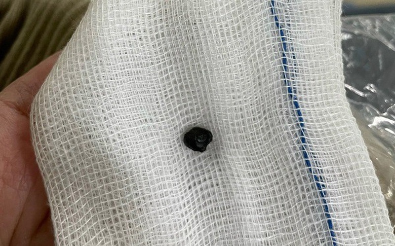 tin tuc doi song moi nhat ngay 3122023 manh dan gam trong vung ham mat nguoi dan ong 56 nam