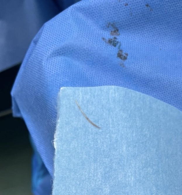 tin tuc doi song moi nhat ngay 3122023 manh dan gam trong vung ham mat nguoi dan ong 56 nam2