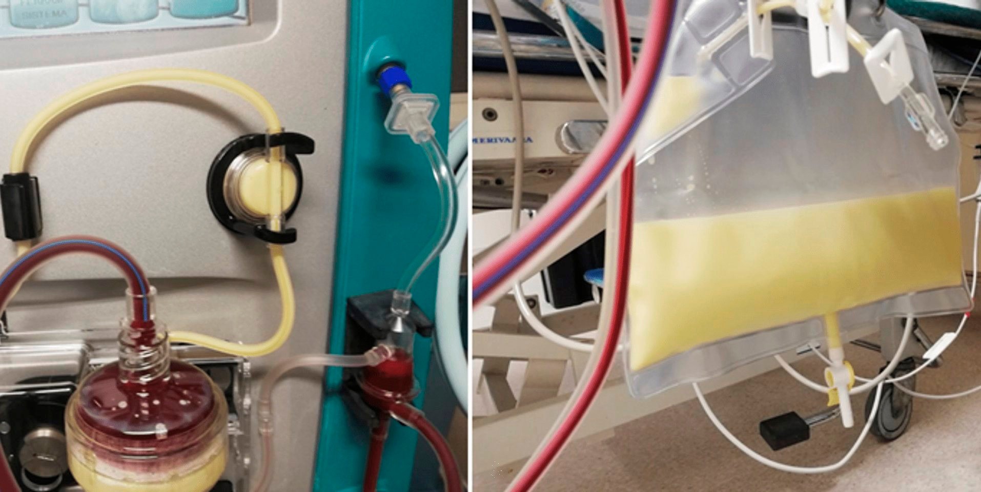 tin tuc doi song moi nhat ngay 6122023 tien giang ghi nhan truong hop mac dau mua khi dau tien1 tin tuc doi song moi nhat ngay 6122023 tien giang ghi nhan truong hop mac dau mua khi dau tien1