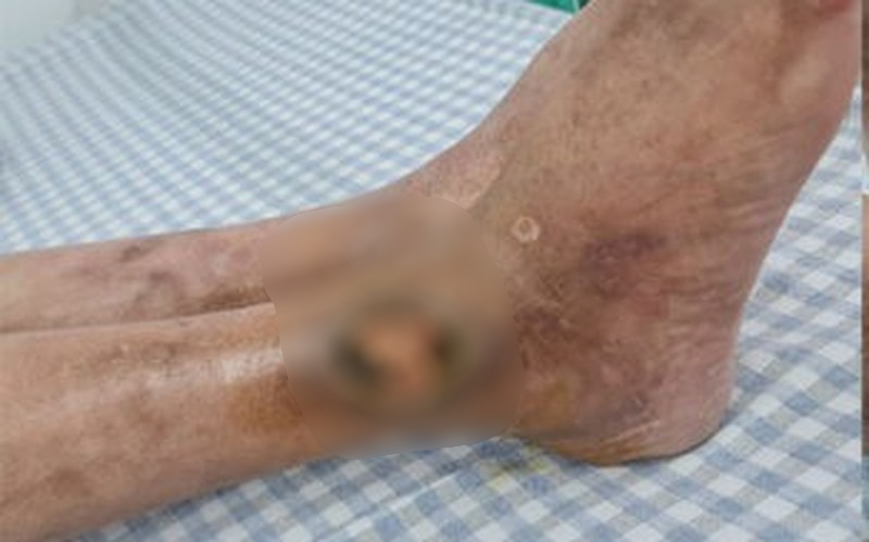 tin tuc doi song moi nhat ngay 812223 be 8 tuoi mac benh ly bam sinh hiem gap1 tin tuc doi song moi nhat ngay 812223 be 8 tuoi mac benh ly bam sinh hiem gap1