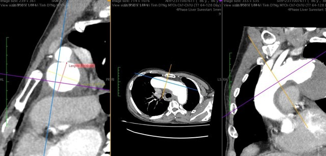 tin tuc doi song moi nhat ngay 10122023 cu ba bi trung dan lac khi dang luom ca phe2