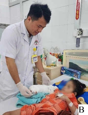tay ao khoac cuon vao banh xe may be gai 5 tuoi gap tai nan thuong tam1 tay ao khoac cuon vao banh xe may be gai 5 tuoi gap tai nan thuong tam1