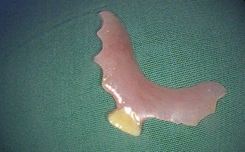 tin tuc doi song moi nhat ngay 522024 nguoi dan ong liet nua nguoi cung luc mac 2 benh ung thu2